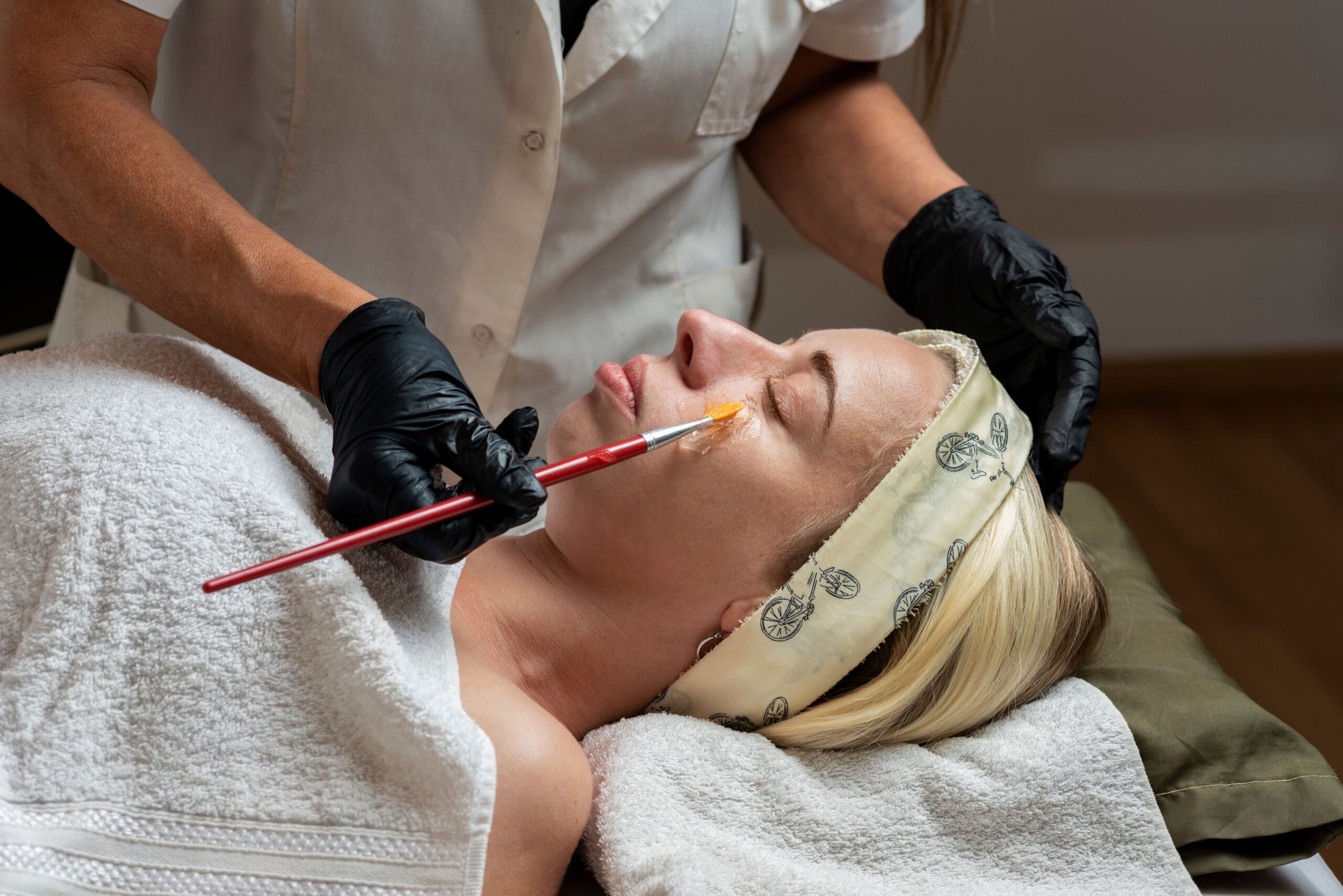 Advanced Chemical Peels